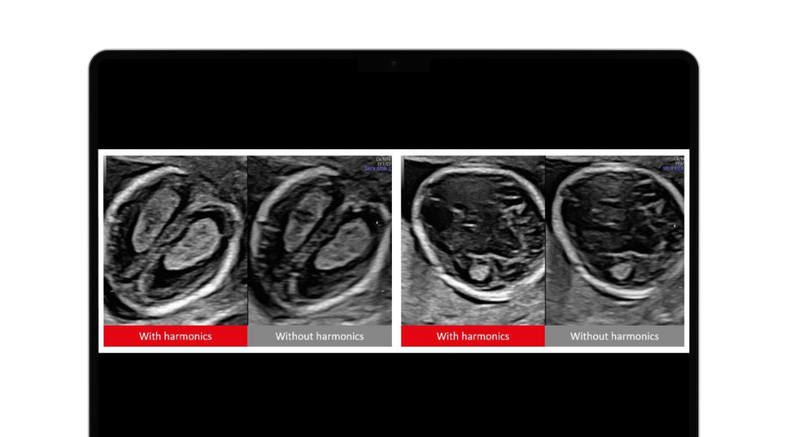 ultrasound-scanning-techniques.png