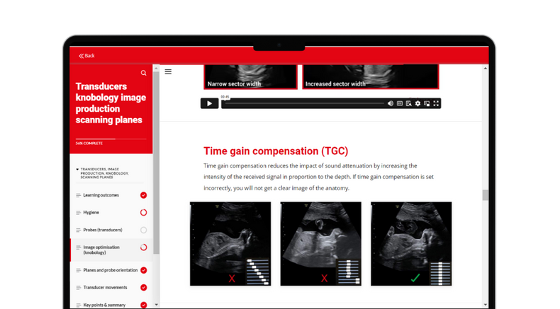 Self-paced-ULTRASOIDN-IN-OBGYNstudy.png