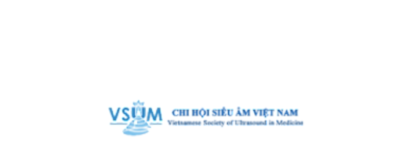 vsum small lowered sharpened.png